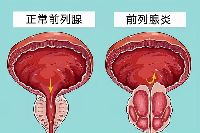 房劳过度