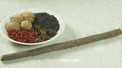 中医讲肾 中医讲肾